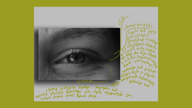 წვრილმანები თვალებთან თვალის ნაოჭები